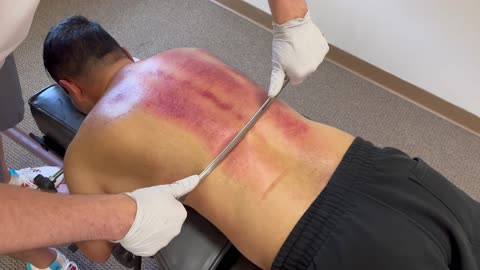 OVERLY TENDER CAN'T TOUCH