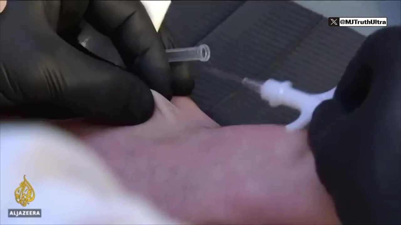 Sweden— Microchips under the skin