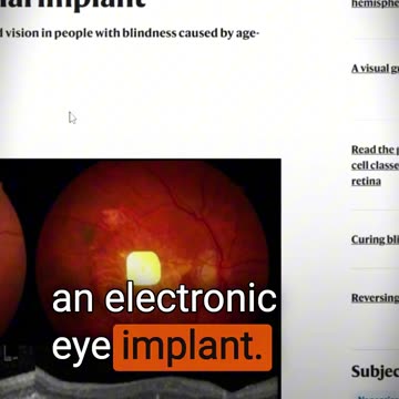 How Blind People Can Read Again With Electronic Eyes 👁️