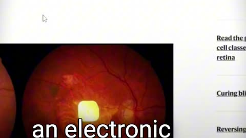 How Blind People Can Read Again With Electronic Eyes 👁️