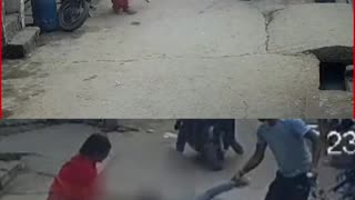 Delhi: Pitbull Rips Off 6-Year-Old’s Ear in Prem Nagar — Owner Arrested After Shocking CCTV Footage