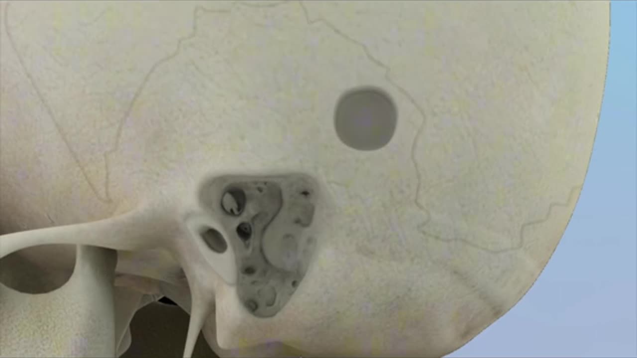 Cochlear Implant 3D Aniamtion