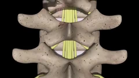 SpinaL Cord Surgery 3D Animation (Lumbar Surgery)