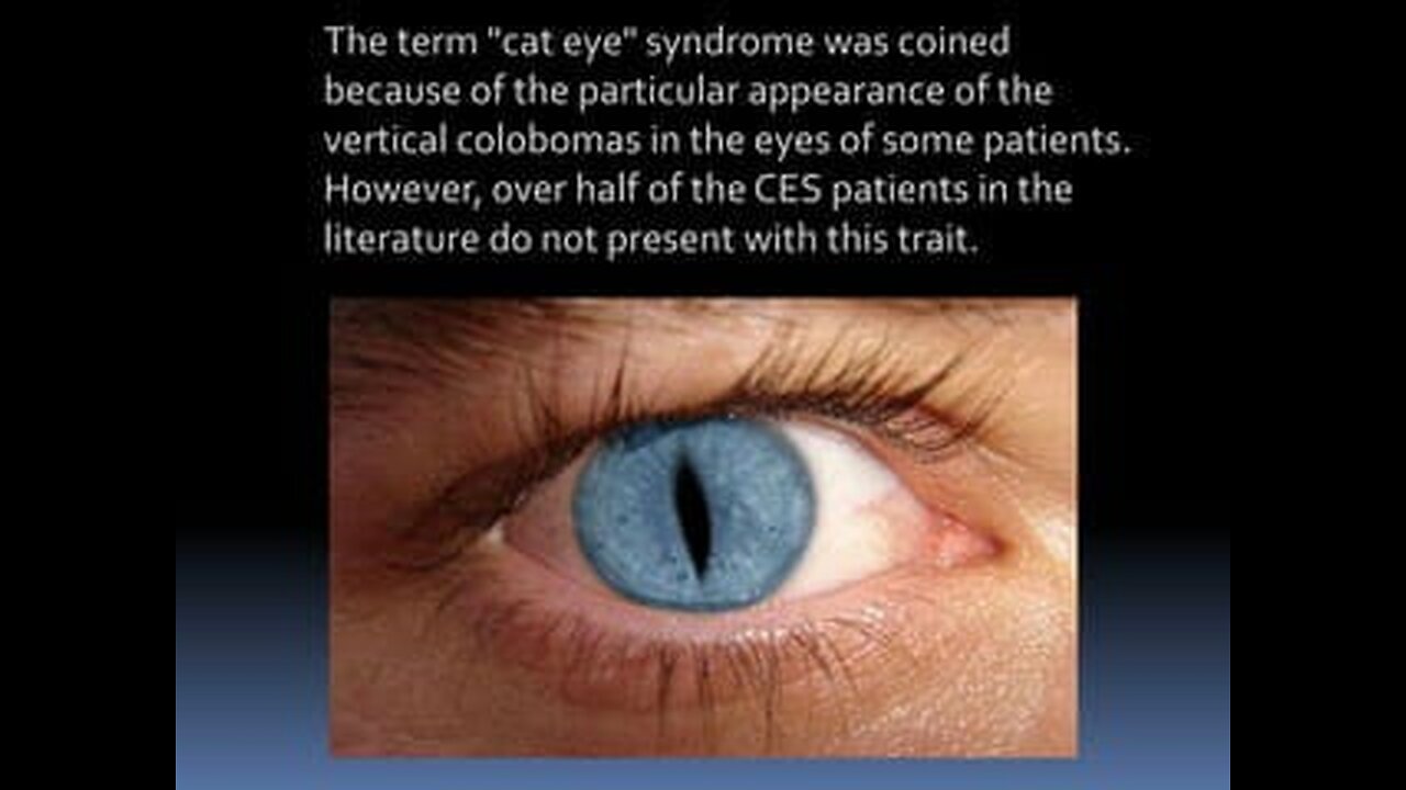 REPTILIAN OVERLORDS DOG RUN THE WORLD AND EWE DON EVEN REAL EYES V 1980S EXPOSURE OF TRUMP AND DI