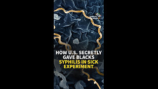 HOW U.S. SECRETLY GAVE BLACKS SYPHILIS IN SICK EXPERIMENT