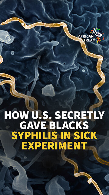 HOW U.S. SECRETLY GAVE BLACKS SYPHILIS IN SICK EXPERIMENT