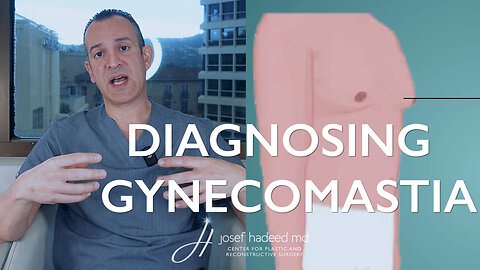 Diagnosing Gynecomastia