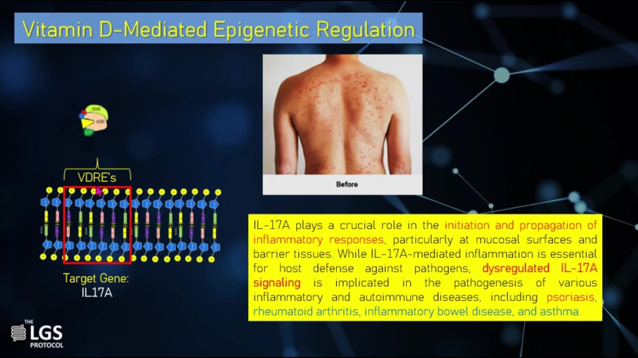 Microbiome-Nutrient Metabolism-Epigenetic Axis