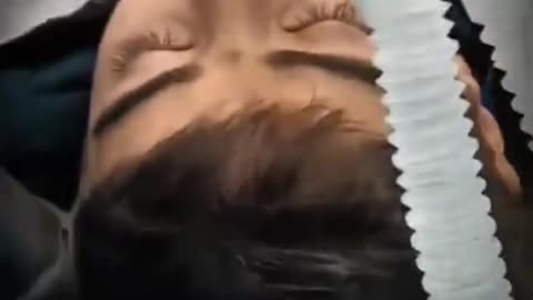 Kidney Stones Removal Procedure