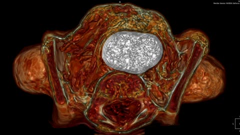 🤰🔬 Top View of Pregnant 60cm Abdomen: Unbelievable Details! | TheTruthAbove