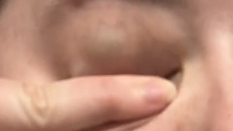 🤯✨ You Can See My Eye Color Through My Eyelids! | FeedMyCuriosity