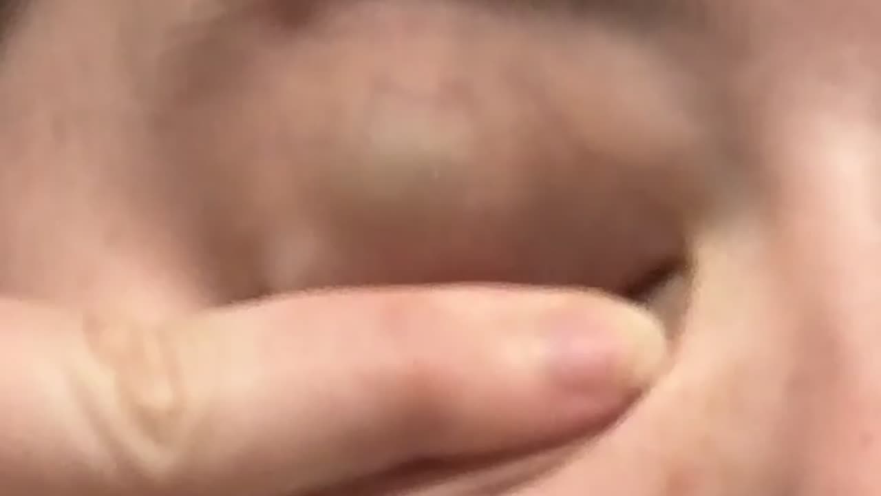 🤯✨ You Can See My Eye Color Through My Eyelids! | FeedMyCuriosity