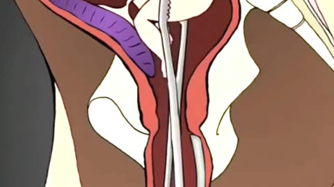 What Actually Happens During an Abortion Procedure?