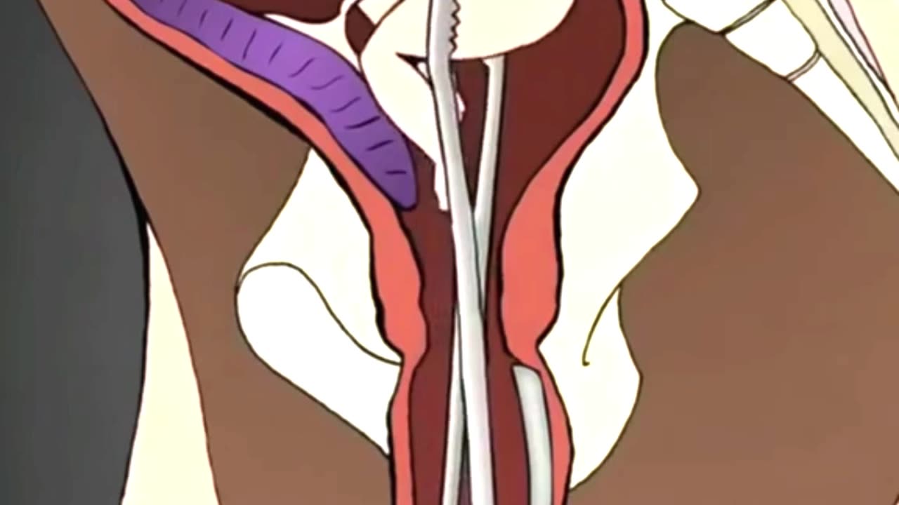 What Actually Happens During an Abortion Procedure?