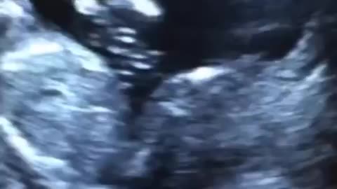 Baby. Before and after birth.