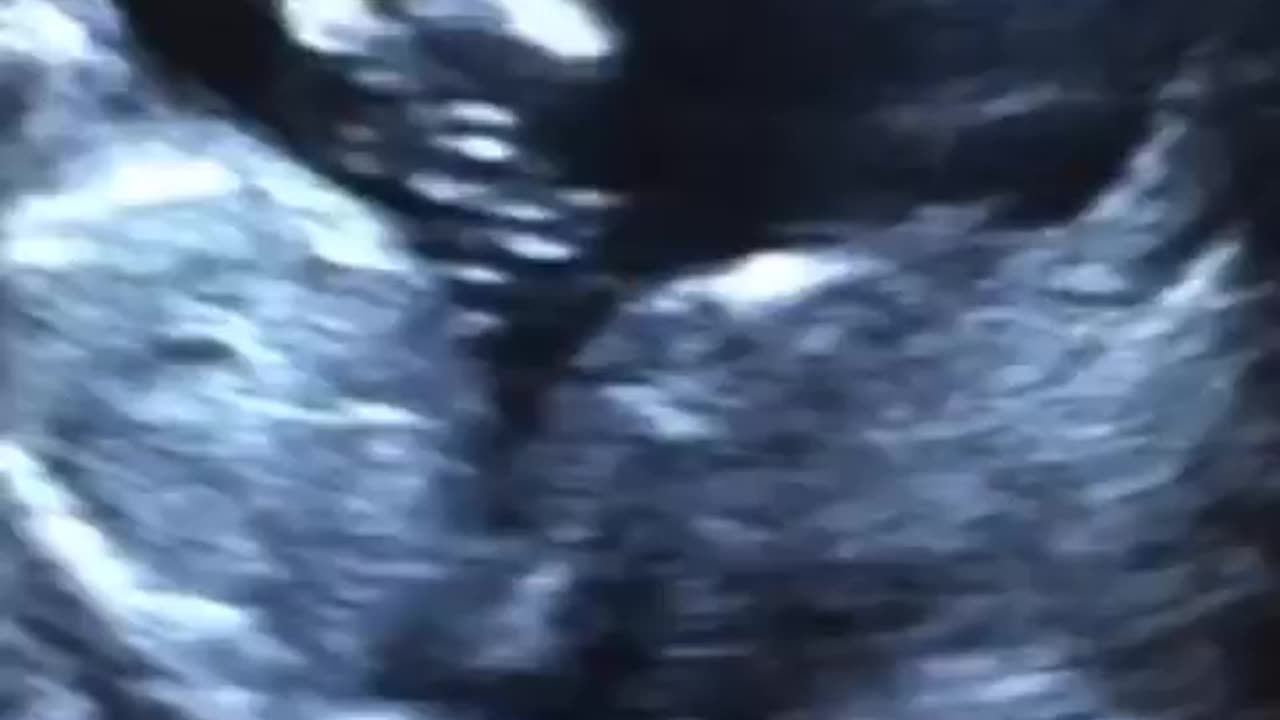 Baby. Before and after birth.