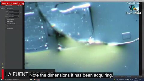 This is a microscopic view of the nanobots and hydrogel structures growing in vaccinated