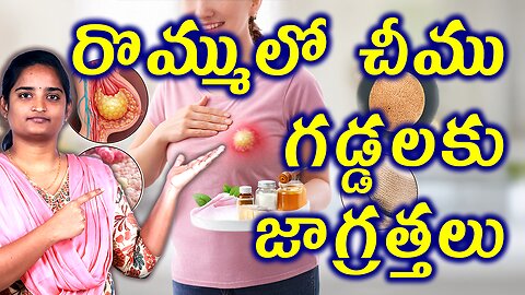 రొమ్ములో చీము గడ్డలకు జాగ్రత్తలు Precautions For Breast Pus Swelling | Breast Boil Homeopathy Cure