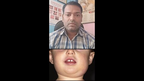 बच्चों के गले और चेहरे पर सूजन ।