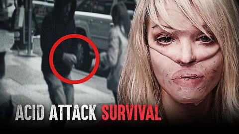 How I Survived an Acid Attack (The Katie Piper Story)