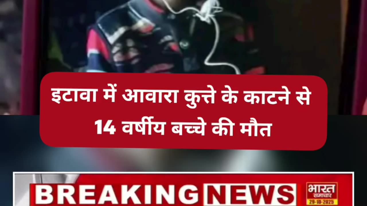 Uttar Pradesh: 14 year old boy died after administration of all doses of rabies vaccine