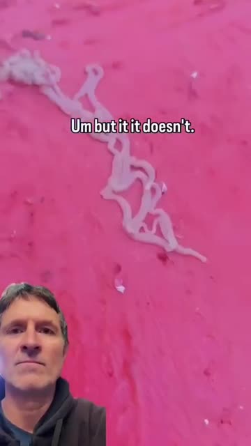 Do your Parasite Cleanses — they are causing the dis-ease.