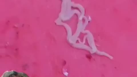 Do your Parasite Cleanses — they are causing the dis-ease.