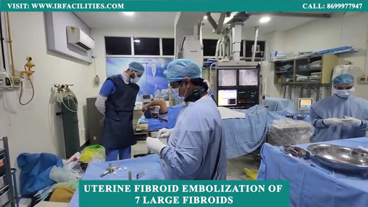 Uterine Fibroid Embolization: 7 Large Fibroids Treated by Dr. Sandeep Sharma