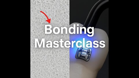 Bonding in Orthodontics