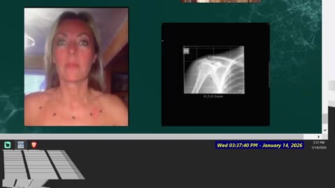 Two of the Best Alien Abduction cases with EVIDENCE. But why are they not FULLY public 2025