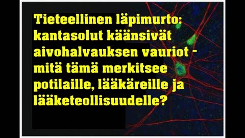 Tieteellinen läpimurto - kantasolut käänsivät aivohalvauksen vauriot