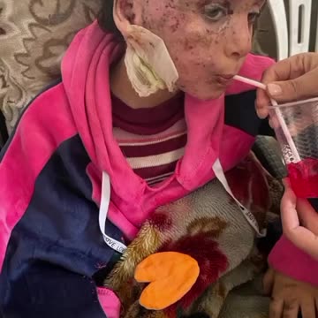 I lost my entire family to genocide… 💔😢