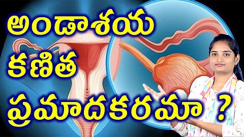 అండాశయ కణిత ప్రమాదకరమా? Risk Factors And Cuases For Ovary Cyst Homeopathy Treatment Cure Surgery