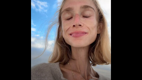 Joven muere tras seguir una dieta frutariana extrema