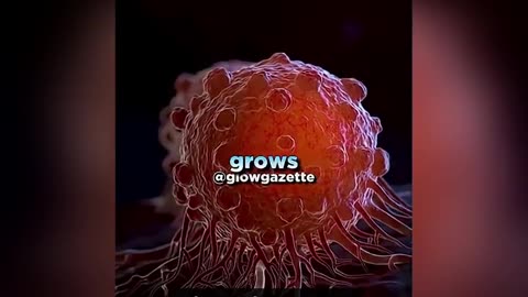 Dr. Thomas Seyfried, Professor für Biologie am Boston College der Blutzuckerspiegel