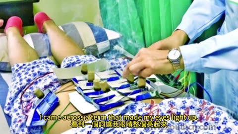 雷射針灸 無痛選擇