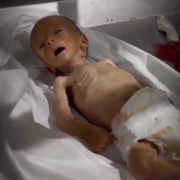 Two-and-a-half-month-old Palestinian toddler Eid Abu Jamaa was martyred