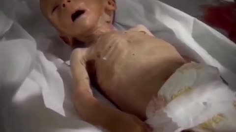 Two-and-a-half-month-old Palestinian toddler Eid Abu Jamaa was martyred