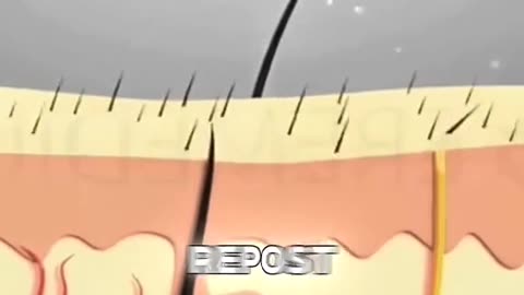 Hair Transplant Surgery Procedure