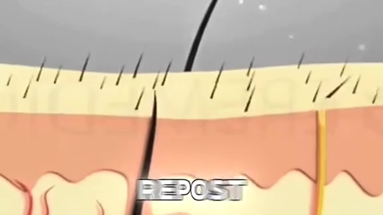 Hair Transplant Surgery Procedure