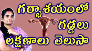 గర్భాశయంలో గడ్డలు లక్షణాలు తెలుసా Signs And Symptoms Of Uterine Disorder | Adinomayosis Homeopathy