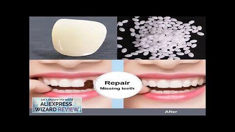 Resin Tooth Permanent high hardness Repair Glue Shapeable Teeth Gaps Filling Teeth Review