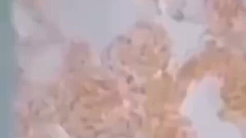 Is Sharing Food And Sex Safe With The Injected? Yay Or Nay?