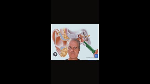 Why is my ear crackling? | Eustachian tube dysfunction