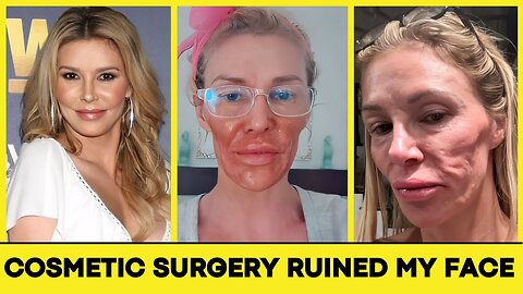 10 Plastic Surgery Disasters You Won’t Believe Happened | Then and Now 2025