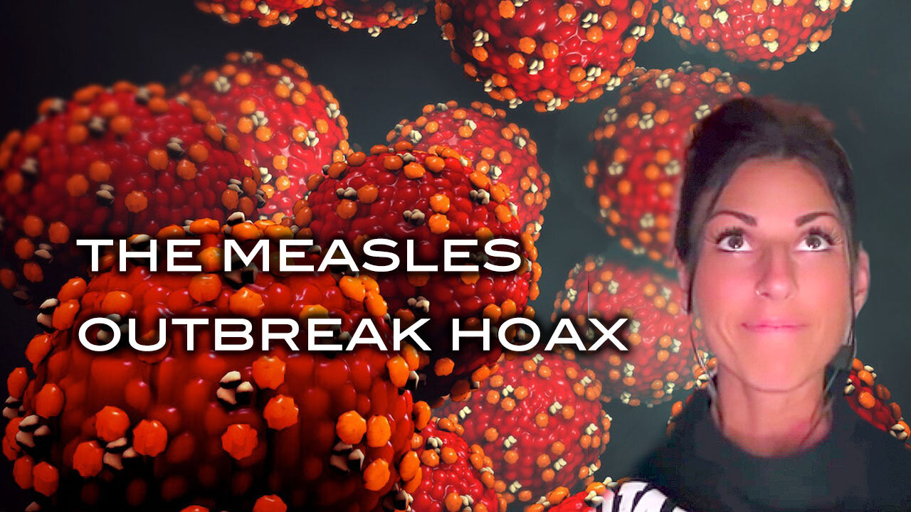 The Measles Outbreak Hoax