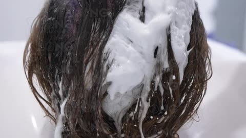 Woman Hair Transplant at Long Hair Center!