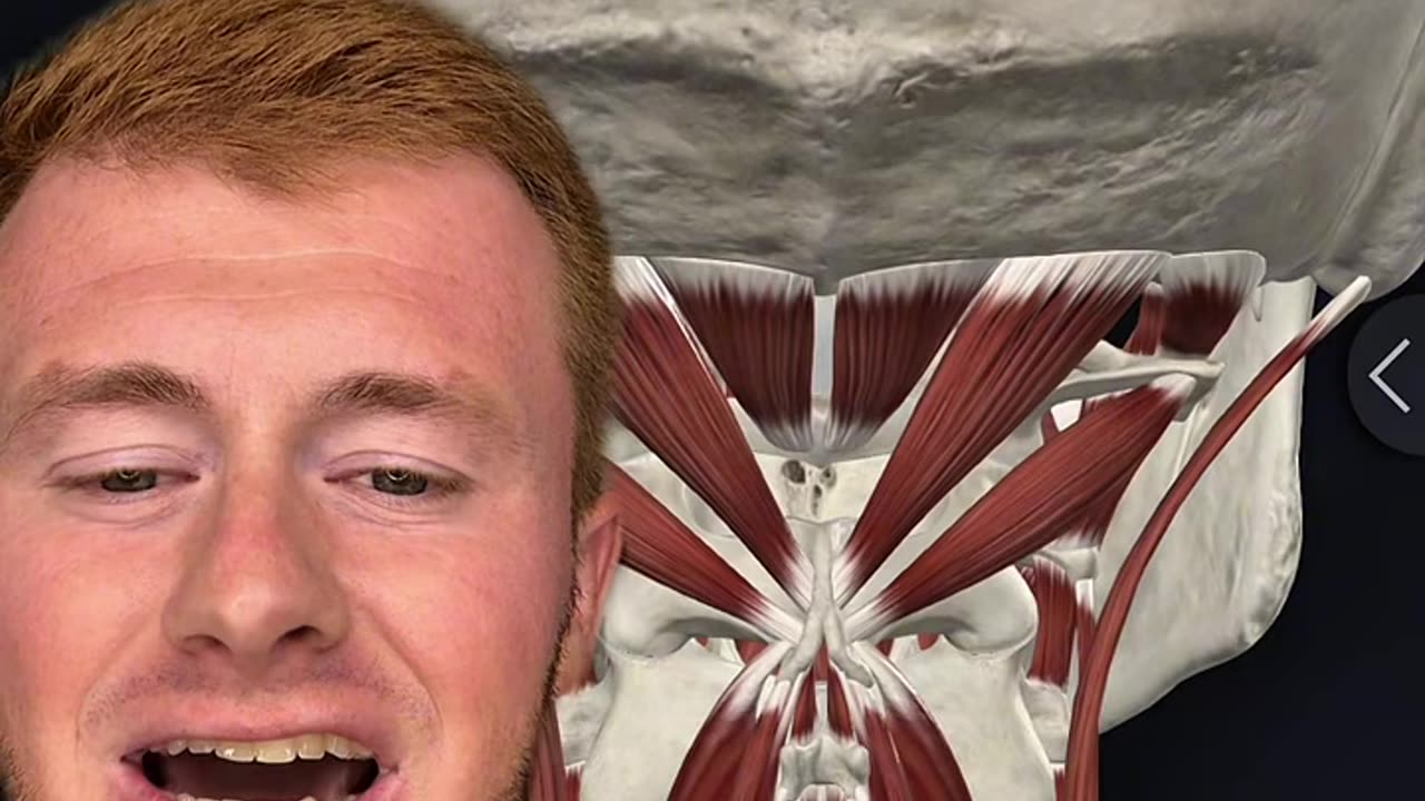 Why do I have vestibular issues? | Vertigo| Dizziness