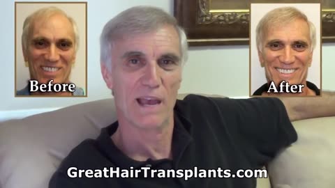 Great Hair Transplants: Dr. Brett Bolton’s Hair Transplant Expertise