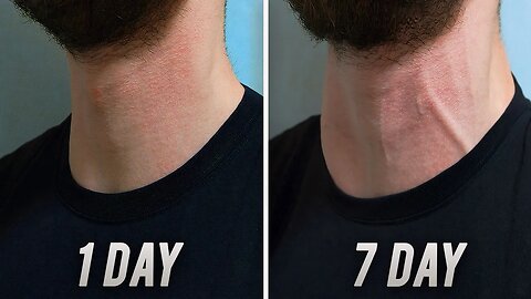 Big Neck in 7 DAYS ! ( Home Exercise | PSN Experiment